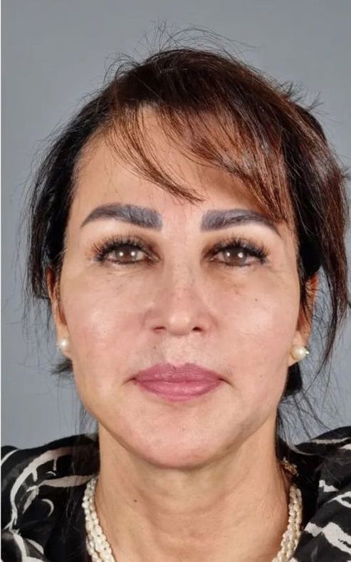 بهترین مرکز ضد پیری در تهران